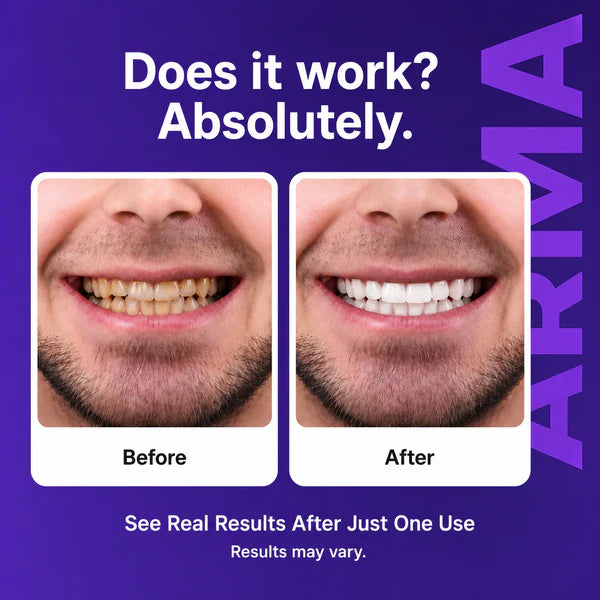Titas Blanqueadoras de dientes ARMA Purple