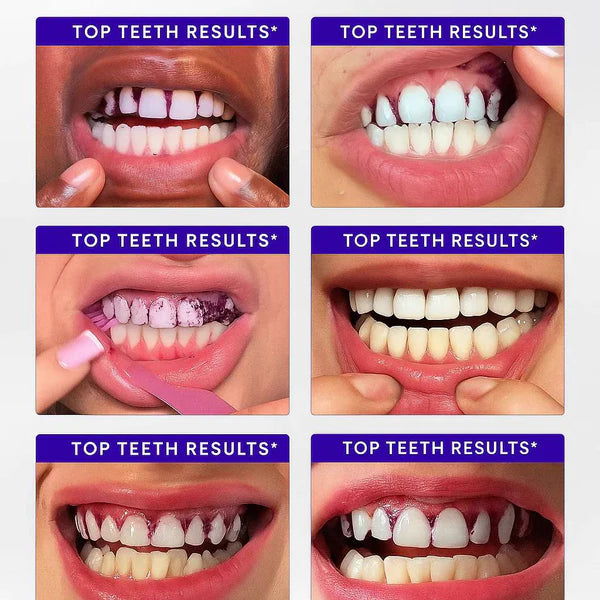 Titas Blanqueadoras de dientes ARMA Purple