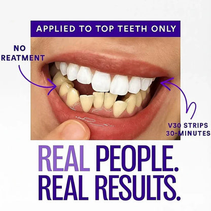 Titas Blanqueadoras de dientes ARMA Purple